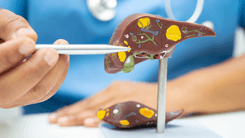 Estudo aponta possível efeito protetor da cannabis sobre o fígado em usuários de álcool