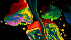 High doses of LSD may help those living with depression