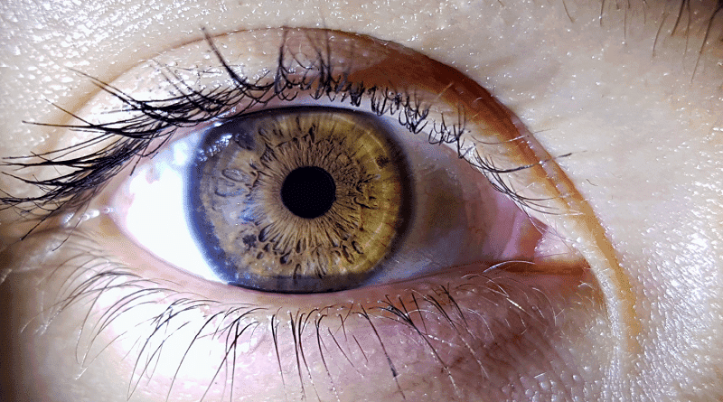 Glaucoma: cannabis pode ser eficaz contra a hipertensão ocular, diz estudo