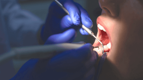 Imagem da noticia: Da dor ao bem-estar: a nova era da odontologia com a cannabis