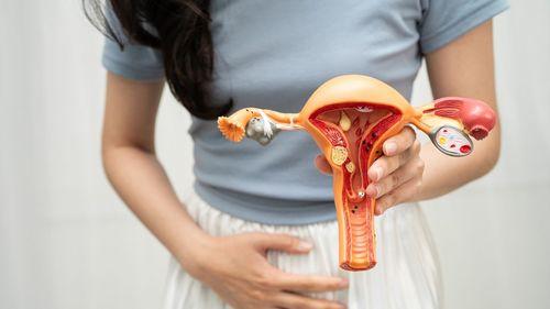 Estudo comprova eficácia da combinação de cannabis contra o câncer de ovário